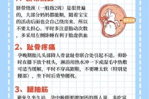 孕期常识大全，孕期小常识100条简短