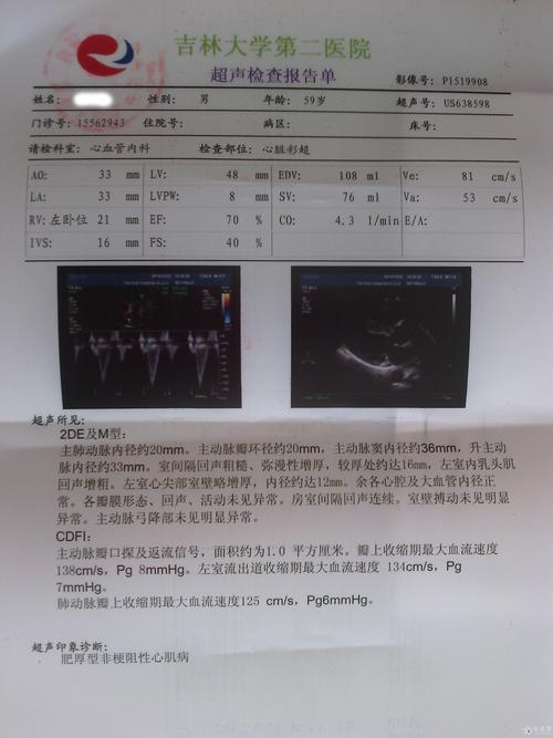 心律失常识别 - 心律失常识别及处理  第4张