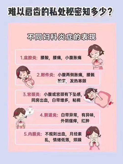 女性妇科常识，女性妇科知识普及  第4张