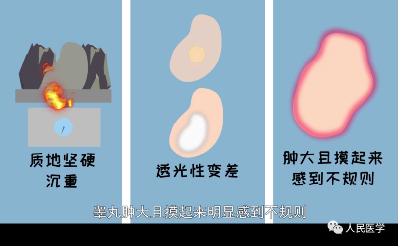 放疗常识是什么意思，放疗的专业术语  第2张