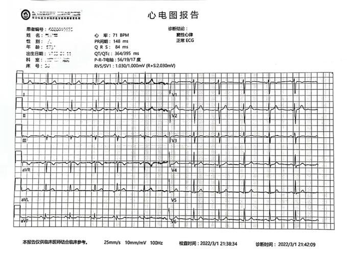 心电图基本常识 - 心电图基本常识,做一个相关PPT  第2张