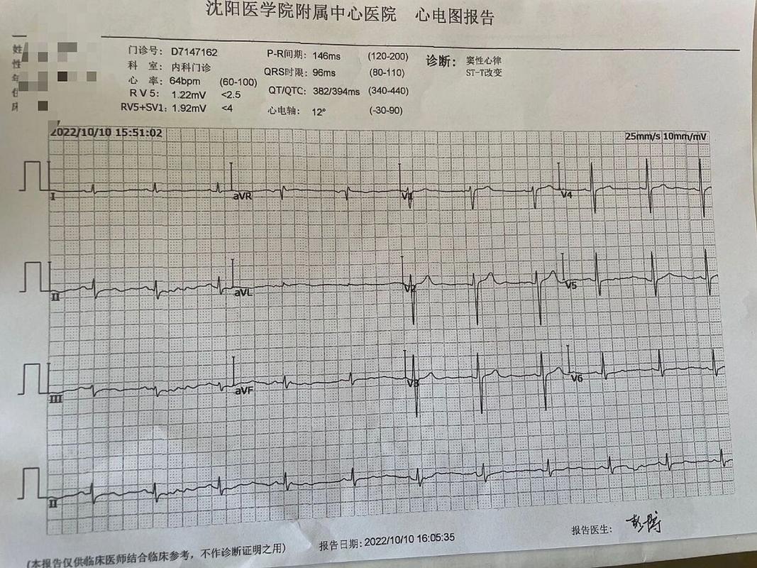 心电图基本常识 - 心电图基本常识,做一个相关PPT  第3张