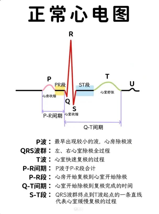 心电图基本常识 - 心电图基本常识,做一个相关PPT  第4张